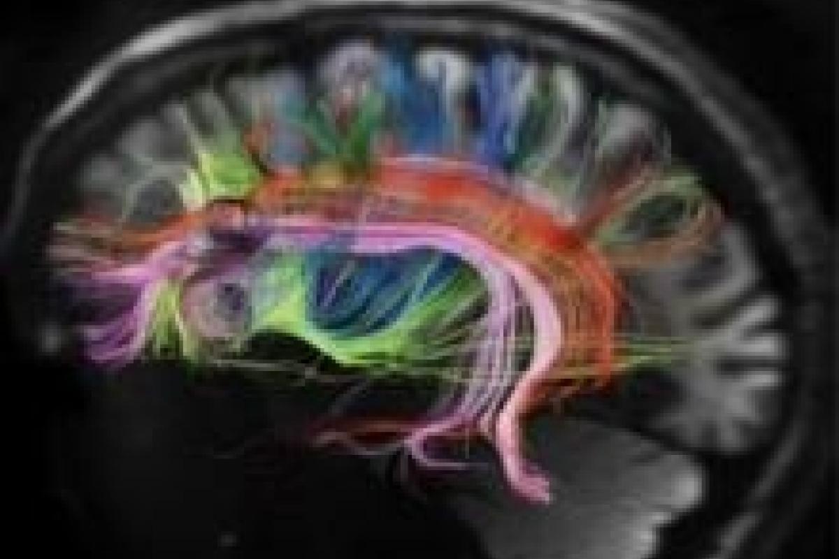 Brain image by Van Weeden, Mass General Hospital, via NIMH