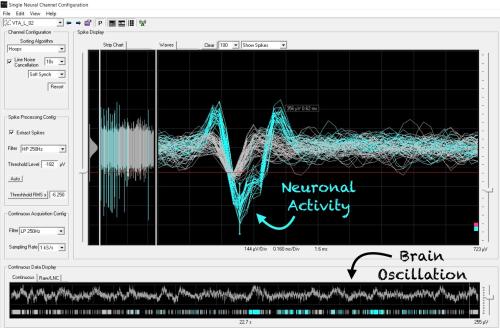 Screenshot of brain activity recordings by K. Abdelaal.